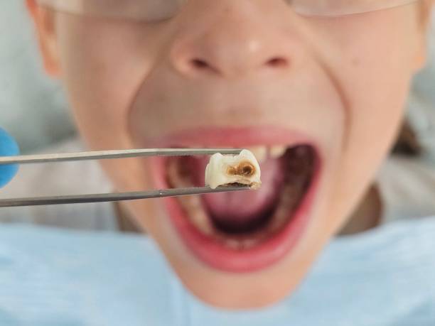 Best After-Hours Dental Trauma Care in Lake Hamilton, AR